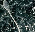 Исследование сперматозоидов в спермограмме